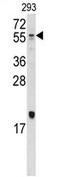 Bone morphogenetic protein 10 antibody, AP11659PU-N, Origene, Western Blot image 