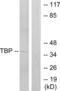 TATA-Box Binding Protein antibody, abx013423, Abbexa, Western Blot image 