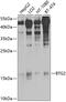 BTG Anti-Proliferation Factor 2 antibody, 23-940, ProSci, Western Blot image 