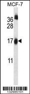 Ubiquitin Conjugating Enzyme E2 W antibody, MBS9213537, MyBioSource, Western Blot image 