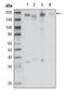 Macrophage Stimulating 1 Receptor antibody, AM06266SU-N, Origene, Western Blot image 