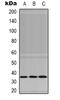 NIMA Related Kinase 7 antibody, orb339050, Biorbyt, Western Blot image 