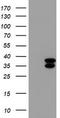 Cytochrome B5 Reductase 3 antibody, TA501294, Origene, Western Blot image 