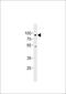 Histone acetyltransferase KAT7 antibody, MBS9203041, MyBioSource, Western Blot image 