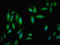 NADH:Ubiquinone Oxidoreductase Subunit B5 antibody, LS-C676134, Lifespan Biosciences, Immunofluorescence image 