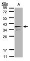 Secretory Carrier Membrane Protein 3 antibody, LS-C185474, Lifespan Biosciences, Western Blot image 