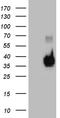 Ribonuclease A Family Member 11 (Inactive) antibody, TA810569S, Origene, Western Blot image 