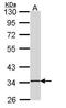 Src Kinase Associated Phosphoprotein 1 antibody, GTX107560, GeneTex, Western Blot image 