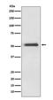 Hnf3b antibody, M01032, Boster Biological Technology, Western Blot image 