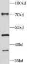 Pentraxin 3 antibody, FNab06306, FineTest, Western Blot image 