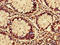 Arginyl-TRNA Synthetase antibody, LS-C396541, Lifespan Biosciences, Immunohistochemistry paraffin image 