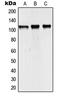 Nuclear Receptor Coactivator 7 antibody, LS-C353631, Lifespan Biosciences, Western Blot image 