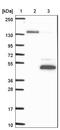 Abhydrolase Domain Containing 1 antibody, NBP1-91644, Novus Biologicals, Western Blot image 