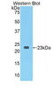 Sirtuin 3 antibody, LS-C298041, Lifespan Biosciences, Western Blot image 