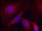 Serine/threonine-protein kinase PAK 1 antibody, PA5-37677, Invitrogen Antibodies, Immunofluorescence image 