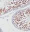 Myocyte Enhancer Factor 2C antibody, FNab05107, FineTest, Immunohistochemistry paraffin image 