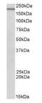 DENN Domain Containing 4C antibody, orb125129, Biorbyt, Western Blot image 