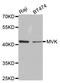 Mevalonate Kinase antibody, LS-C334003, Lifespan Biosciences, Western Blot image 