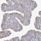 Zinc Finger CCCH-Type Containing 6 antibody, HPA036019, Atlas Antibodies, Immunohistochemistry paraffin image 