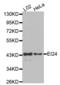 EI24 Autophagy Associated Transmembrane Protein antibody, abx002315, Abbexa, Western Blot image 