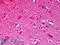 NMDAR2B antibody, LS-C227783, Lifespan Biosciences, Immunohistochemistry paraffin image 