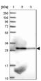 Translocase Of Inner Mitochondrial Membrane 29 antibody, PA5-59759, Invitrogen Antibodies, Western Blot image 