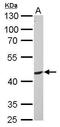 Phosphatidylinositol 3-kinase regulatory subunit gamma antibody, TA308969, Origene, Western Blot image 