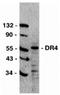 PARD6A antibody, orb18626, Biorbyt, Western Blot image 