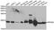 Protein Phosphatase 3 Regulatory Subunit B, Beta antibody, abx006992, Abbexa, Western Blot image 