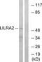 Leukocyte Immunoglobulin Like Receptor A2 antibody, TA315142, Origene, Western Blot image 