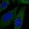 Fibroblast Growth Factor Receptor 3 antibody, HPA067204, Atlas Antibodies, Immunofluorescence image 