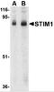 Stromal Interaction Molecule 1 antibody, 4119, ProSci, Western Blot image 