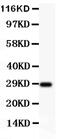proBDNF antibody, PB9075, Boster Biological Technology, Western Blot image 
