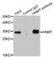 Histamine N-Methyltransferase antibody, LS-C332135, Lifespan Biosciences, Immunoprecipitation image 