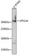 VPS13A antibody, 16-940, ProSci, Western Blot image 