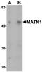 Matrilin 1 antibody, NBP1-76325, Novus Biologicals, Western Blot image 