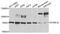 Dual Specificity Tyrosine Phosphorylation Regulated Kinase 1A antibody, A0595, ABclonal Technology, Western Blot image 
