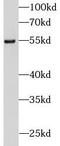 DEAD-Box Helicase 25 antibody, FNab02302, FineTest, Western Blot image 