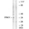 Serine/threonine-protein kinase PRKY antibody, A14965, Boster Biological Technology, Western Blot image 