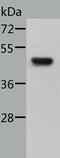 STE20 Related Adaptor Beta antibody, TA324159, Origene, Western Blot image 