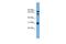 SH3 domain-containing kinase-binding protein 1 antibody, NBP1-57065, Novus Biologicals, Western Blot image 