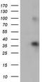 ZFP36 Ring Finger Protein antibody, TA502378, Origene, Western Blot image 