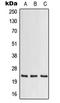 Colony Stimulating Factor 2 antibody, LS-C353733, Lifespan Biosciences, Western Blot image 