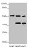 Protein Phosphatase 2 Regulatory Subunit Bdelta antibody, LS-C679128, Lifespan Biosciences, Western Blot image 