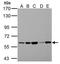 Pyruvate Kinase L/R antibody, TA308453, Origene, Western Blot image 