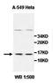 Cyclin-dependent kinase 4 inhibitor B antibody, orb76928, Biorbyt, Western Blot image 