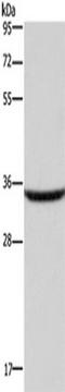 Dickkopf WNT Signaling Pathway Inhibitor 3 antibody, TA349296, Origene, Western Blot image 