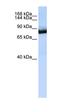 Unc-5 Netrin Receptor C antibody, orb330418, Biorbyt, Western Blot image 