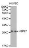 Heat Shock Protein Family B (Small) Member 1 antibody, TA332377, Origene, Western Blot image 
