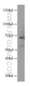 Fibulin 5 antibody, 12188-1-AP, Proteintech Group, Western Blot image 